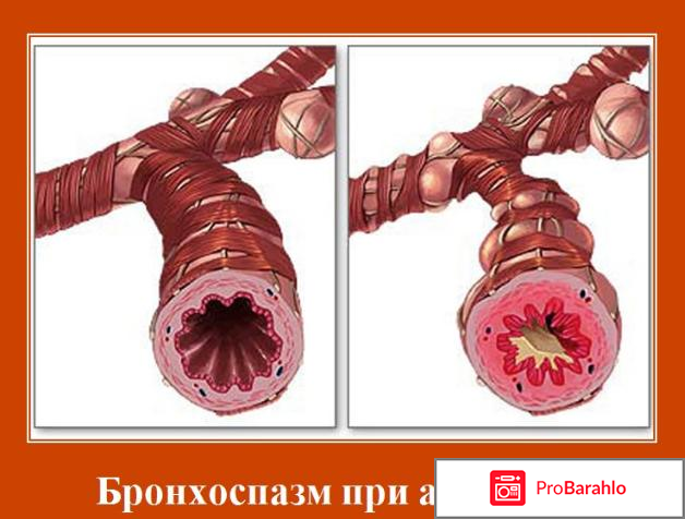 Синглон инструкция по применению цена отзывы обман