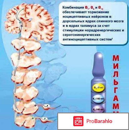 Мильгамма уколы отзывы врачей обман
