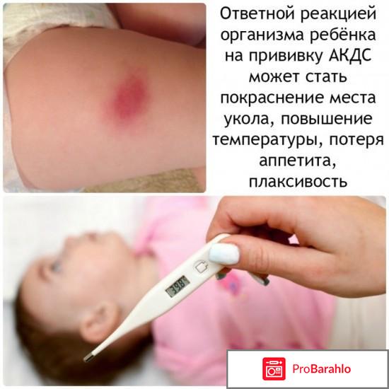 Прививка АКДС реальные отзывы