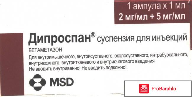 Уколы Дипроспан обман