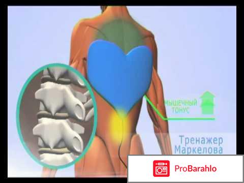 Тренажер маркелова 
