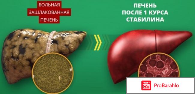 Стабилен инструкция по применению цена отрицательные отзывы