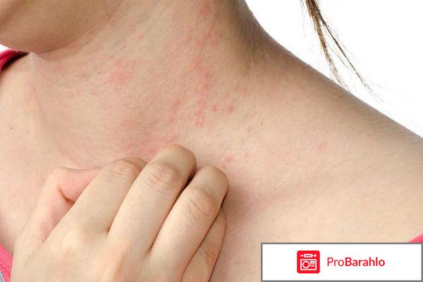 Фемостон 1/5 конти при постменопаузе за и против отзывы отрицательные отзывы