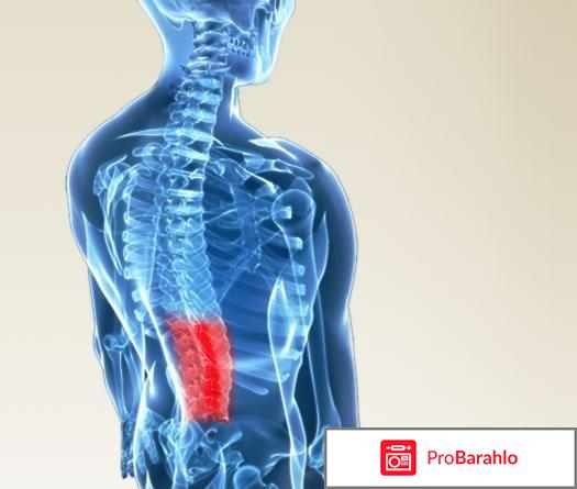 Миелопатия 