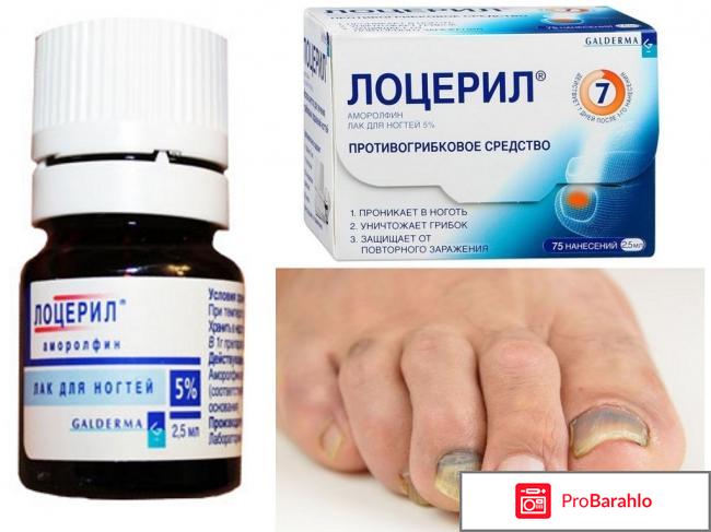 Лоцерил отзывы 