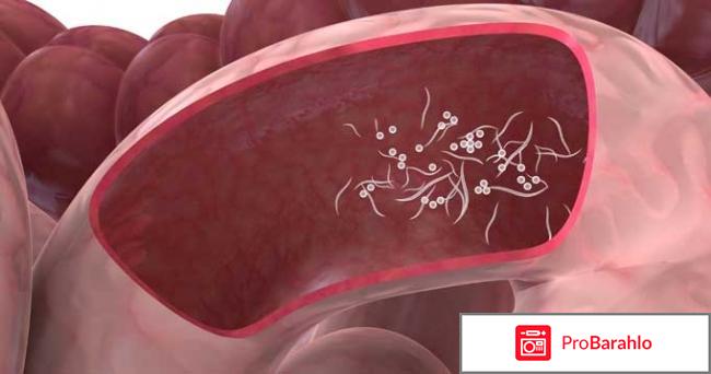 Интоксик (Intoxic) отрицательные отзывы
