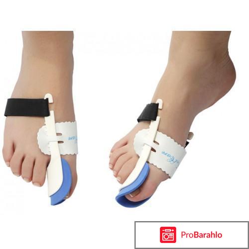 Вальгусная шина отзывы отрицательные отзывы