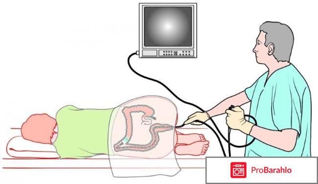 Где сделать колоноскопию кишечника под наркозом обман