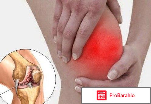 Артрозан таблетки отзывы отрицательные отзывы