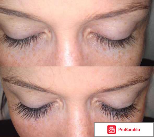 Витамин аевит для чего полезен женщинам отзывы обман