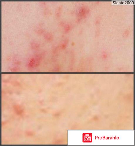 Отзывы клензит с отрицательные отзывы