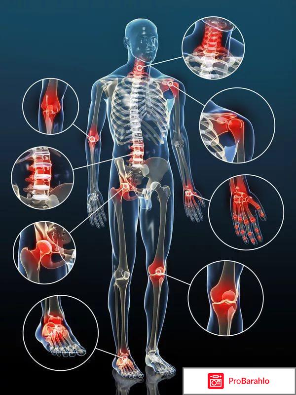 OsteoMax — ОСТЕОМАКС отрицательные отзывы