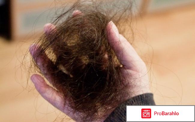 Выпадение волос форум отзывы 