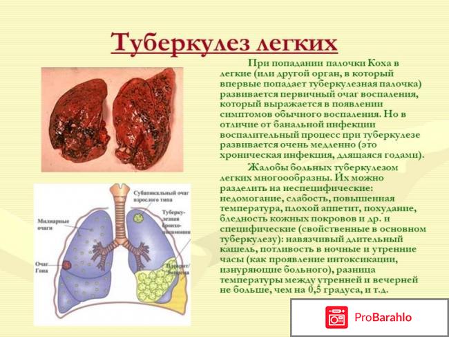 Туберкулёз симптомы обман