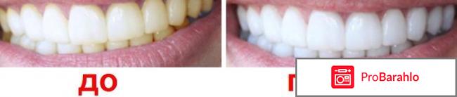 Система домашнего отбеливания зубов отрицательные отзывы