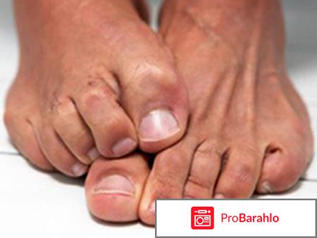 Фундизол отрицательные отзывы