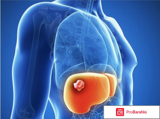 Эспа-липон отрицательные отзывы