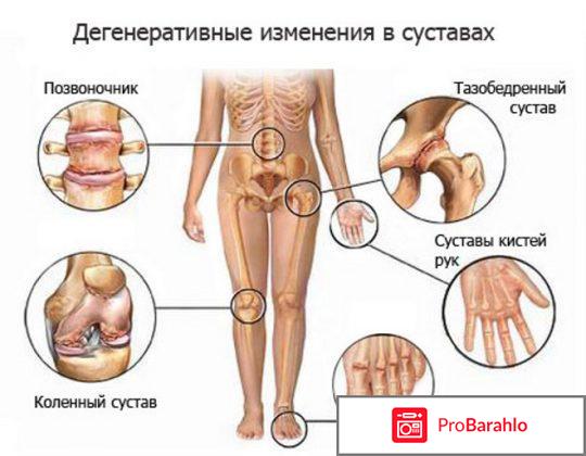 Румалон отзывы больных применяющих этот препарат отрицательные отзывы