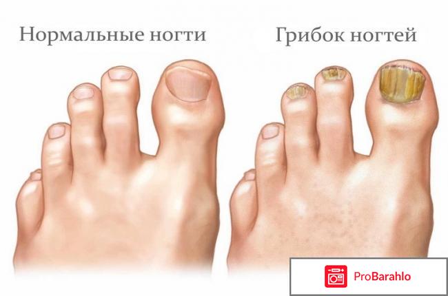 Tinedol (Тинедол) фото