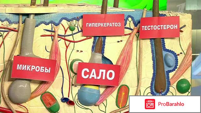 Причины появления прыщей обман