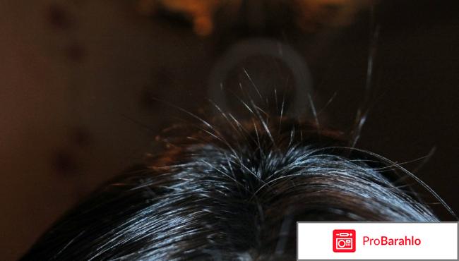 Селенцин трихологов 