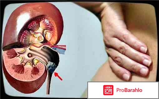 Уралит у купить в екатеринбурге 