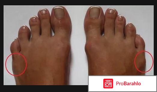 Шишка стоп отзывы отрицательные обман