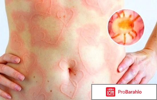 Постельный клещ отрицательные отзывы