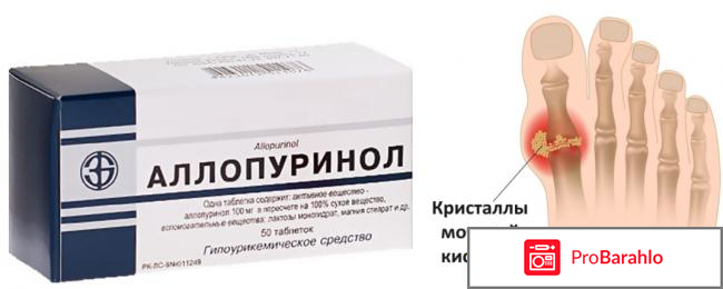 Препараты выводящие мочевую кислоту из организма отрицательные отзывы