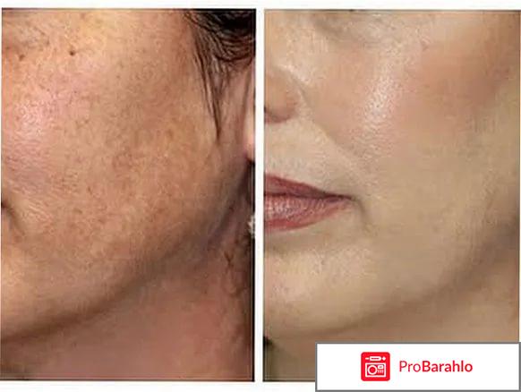 Welltox отрицательные отзывы