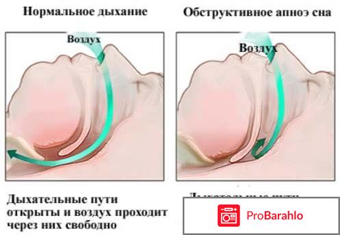 Minusnor отрицательные отзывы