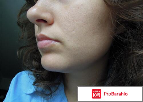 Papilight Comfort фото