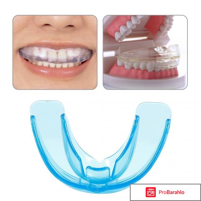 Трейнеры smile corrector реальные отзывы 