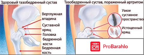 Диафлекс инструкция по применению цена отзывы таблетки 