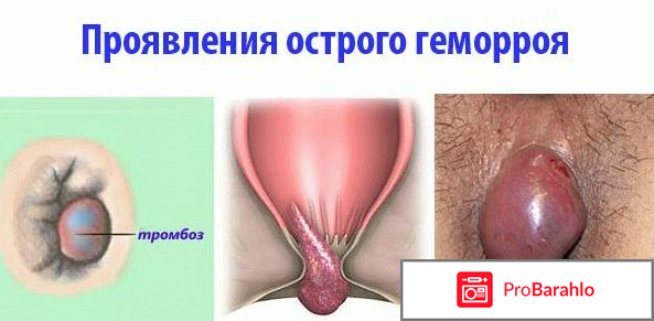 Метилурацил мазь цена отзывы отрицательные отзывы