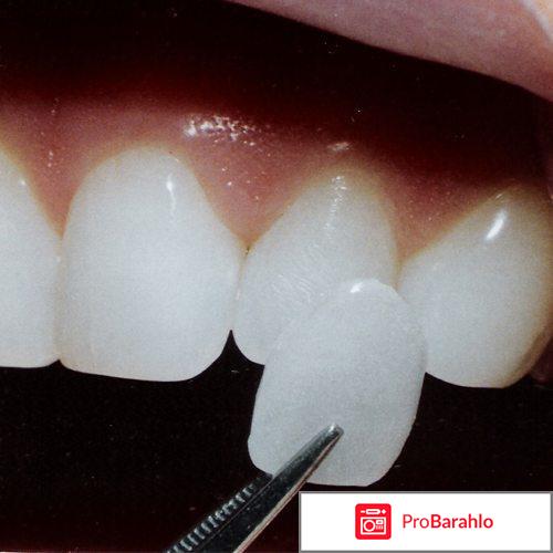 Виниры на зубы фото отзывы отрицательные отзывы