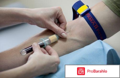 Анализ на онкомаркеры са-125 норма 