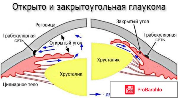Дорзопт глазные капли инструкция цена отзывы 