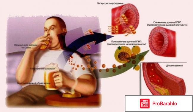 Снижение холестерина народными средствами обман