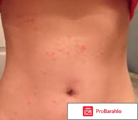 Белодерм инструкция по применению цена отзывы отрицательные отзывы