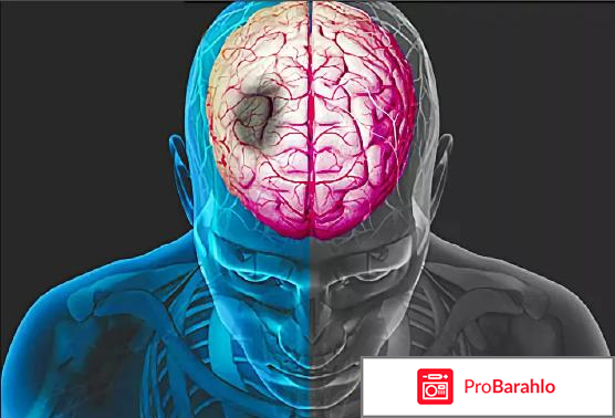 Винпоцетин отзывы 