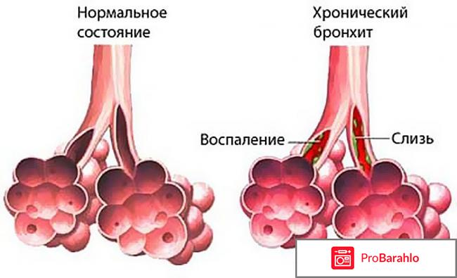 Отзывы о врачах ижевск обман