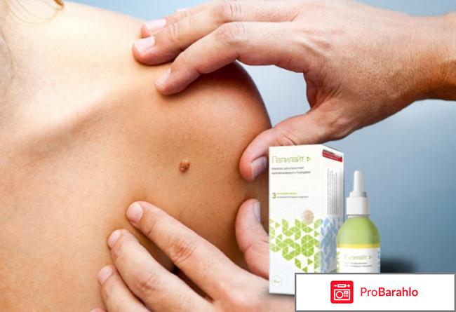 Папилайт это развод или правда? обман