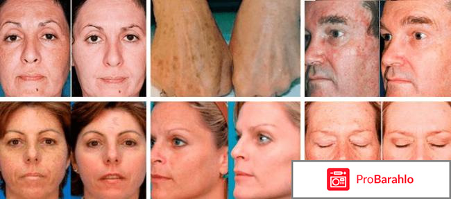 Milk skin отрицательные отзывы отзывы владельцев