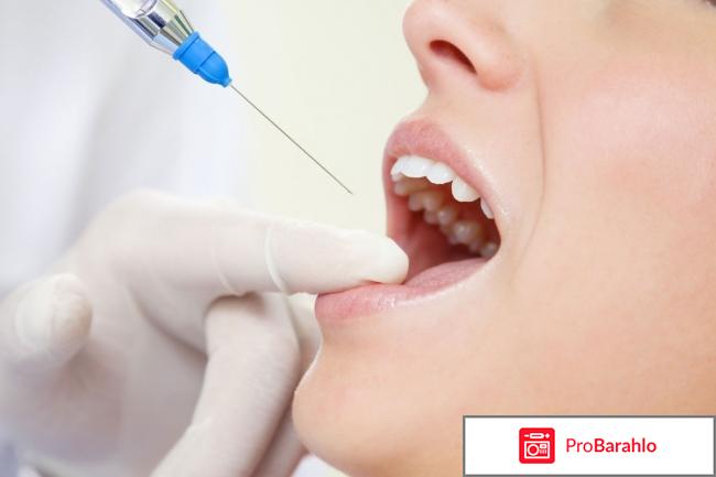 Ультракаин Dс реальные отзывы