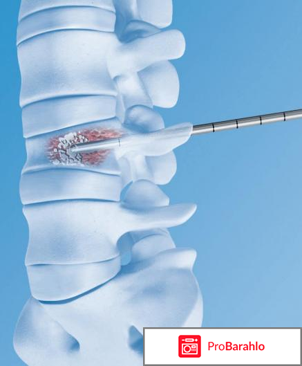 Гемангиома позвоночника к какому врачу обратиться обман