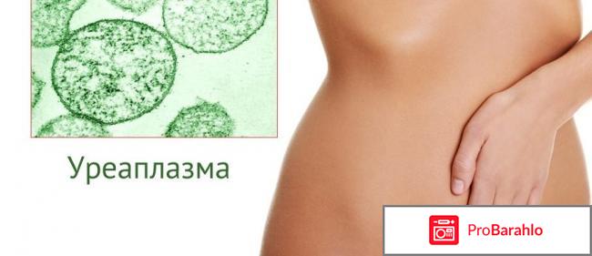 Уреаплазма у женщин симптомы и лечение отзывы отрицательные отзывы