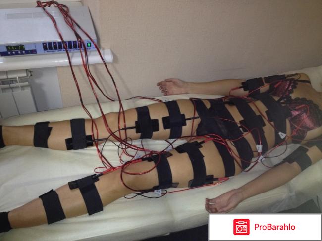 Миостимуляция тела отзывы 