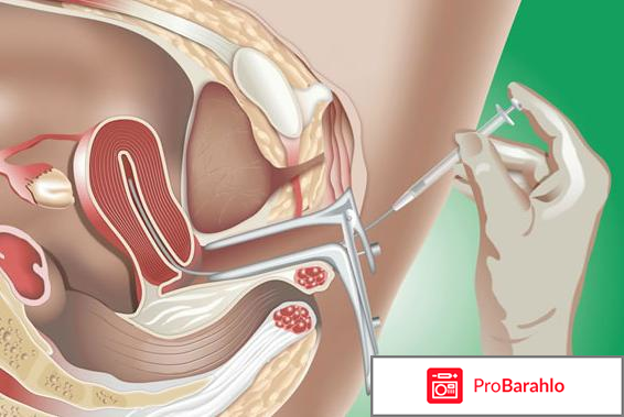 Сколько стоит сперма донора отрицательные отзывы