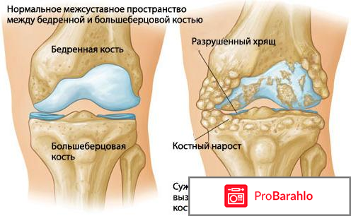 Найзилат инструкция по применению отзывы 